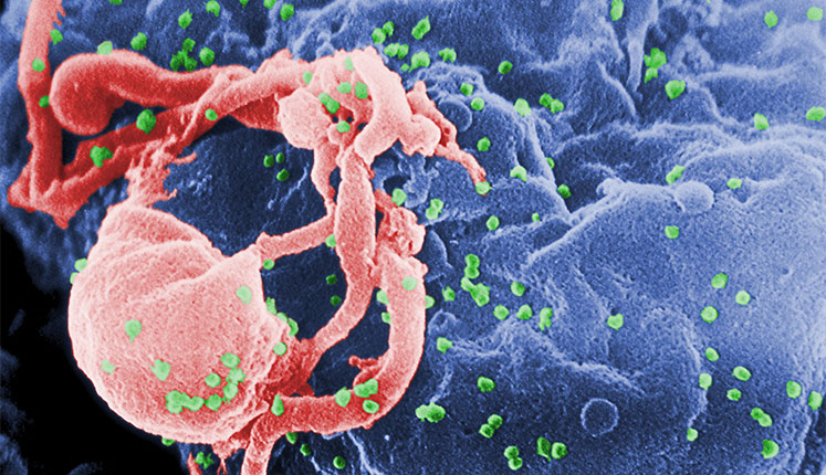 hiv - 10 Greatest Scientific Discoveries and Inventions of 21st Century